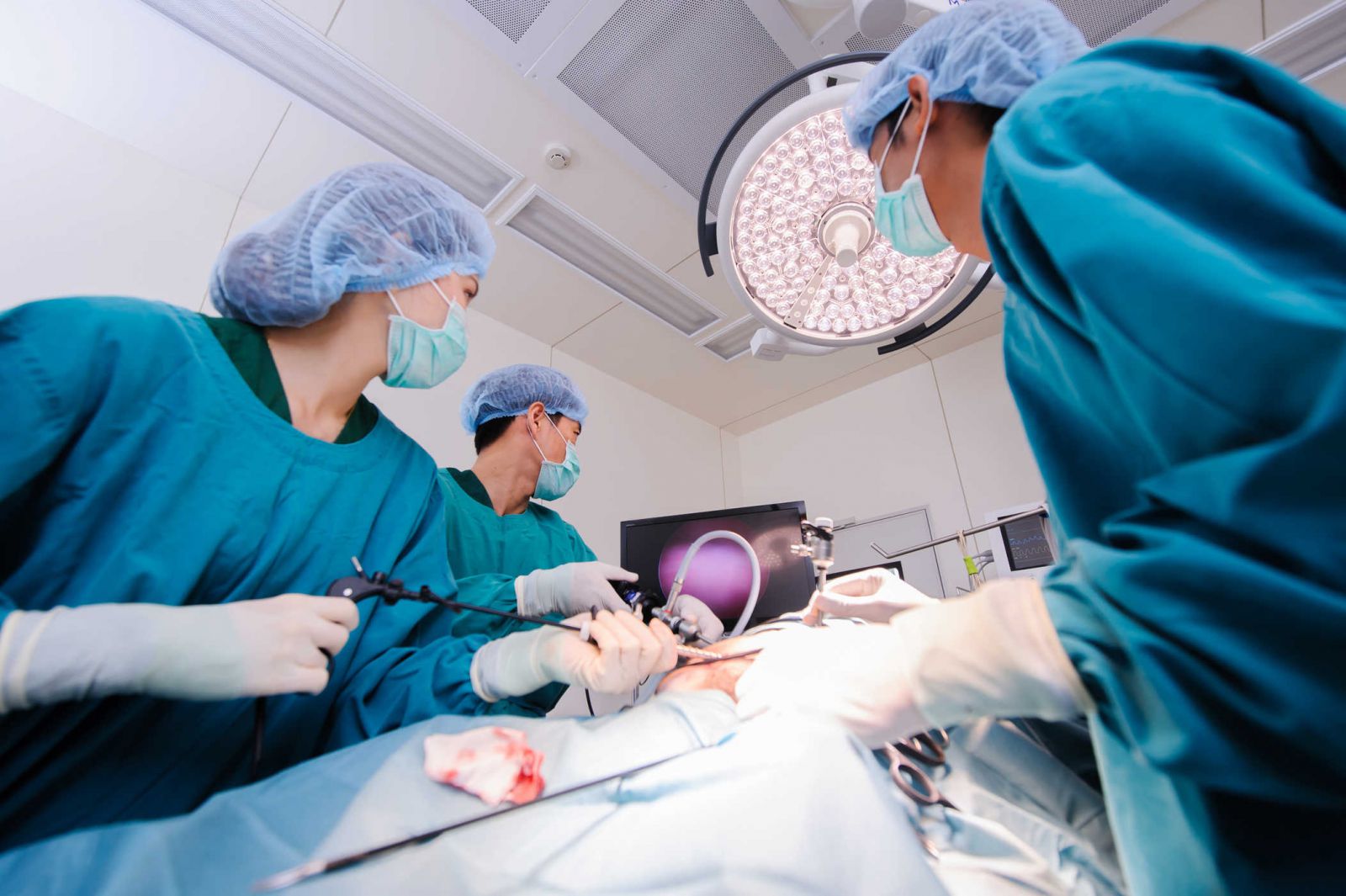 Phẫu thuật sa trực tràng bằng kỹ thuật PPH có nhiều ưu điểm
